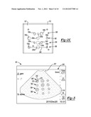 Method and Apparatus for Calibrating and Re-aligning an Ultrasound Image     Plane to a Navigation Tracker diagram and image