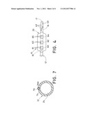 FEEDING TUBE HAVING ECHOGENIC TIP diagram and image