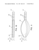 FEEDING TUBE HAVING ECHOGENIC TIP diagram and image