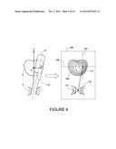 METHOD AND A DUAL-ARRAY TRANSDUCER PROBE FOR REAL TIME MECHANICAL IMAGING     OF PROSTATE diagram and image