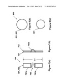 Shape and Pressure Adjustable Dressing diagram and image