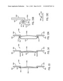 Shape and Pressure Adjustable Dressing diagram and image