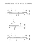 Shape and Pressure Adjustable Dressing diagram and image