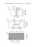 Shape and Pressure Adjustable Dressing diagram and image