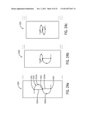 Shape and Pressure Adjustable Dressing diagram and image