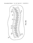 Shape and Pressure Adjustable Dressing diagram and image