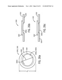 Shape and Pressure Adjustable Dressing diagram and image