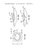 Shape and Pressure Adjustable Dressing diagram and image