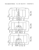 Shape and Pressure Adjustable Dressing diagram and image