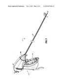 Natural Orifice Bariatric Procedure and Apparatus for Use Therewith diagram and image