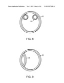 HARVESTING FAT TISSUE USING TISSUE LIQUEFACTION diagram and image