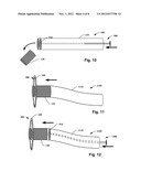 OSTOMY DEVICE diagram and image