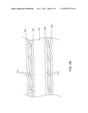 CATHETER HAVING A SELECTIVELY VARIABLE DEGREE OF FLEXIBILITY diagram and image