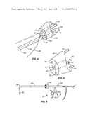 Laparoscopic Laser Device and Method diagram and image