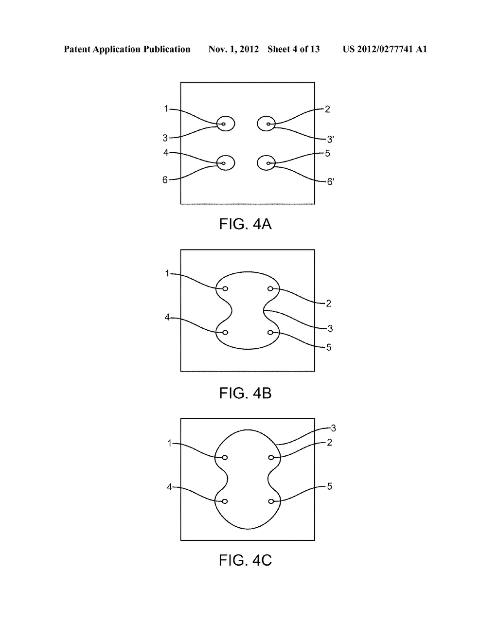 TISSUE ABLATION WITH IRREVERSIBLE ELECTROPORATION - diagram, schematic, and image 05