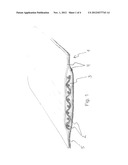 IMPLANT SYSTEM diagram and image