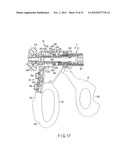 ULTRASONIC SURGICAL INSTRUMENT diagram and image