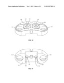 BONE PLATE & METHOD FOR MANUFACTURING diagram and image