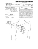 PACING IN THE PRESENCE OF ELECTROMAGENTIC INTERFERENCE diagram and image