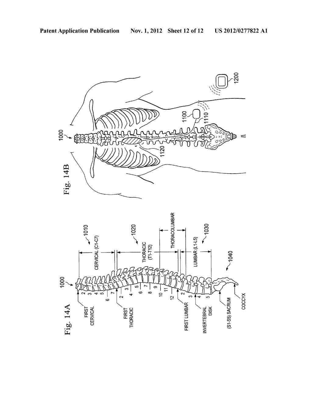 Current Steering Neurostimulator Device with Unidirectional Current     Sources - diagram, schematic, and image 13