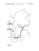 DUAL PROPHYLACTIC AND ABORTIVE ELECTRICAL STIMULATION diagram and image