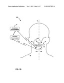 DUAL PROPHYLACTIC AND ABORTIVE ELECTRICAL STIMULATION diagram and image