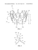 STENT AND STENT-GRAFT DESIGNS diagram and image