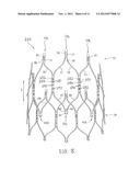 STENT AND STENT-GRAFT DESIGNS diagram and image