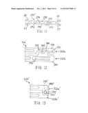 STENT AND STENT-GRAFT DESIGNS diagram and image