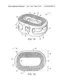 SPINAL IMPLANT HAVING A PASSAGE FOR ENHANCING CONTACT BETWEEN BONE GRAFT     MATERIAL AND CORTICAL ENDPLATE BONE diagram and image