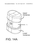 SPINAL IMPLANT HAVING A PASSAGE FOR ENHANCING CONTACT BETWEEN BONE GRAFT     MATERIAL AND CORTICAL ENDPLATE BONE diagram and image