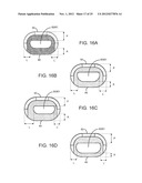 SPINAL IMPLANT HAVING A PASSAGE FOR ENHANCING CONTACT BETWEEN BONE GRAFT     MATERIAL AND CORTICAL ENDPLATE BONE diagram and image