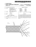 SECURED STRAND END DEVICES diagram and image