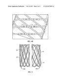 SECURED STRAND END DEVICES diagram and image