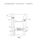 INTERFEROMETRIC MATERIAL SENSING APPARATUS INCLUDING ADJUSTABLE REFERENCE     ARM AND ASSOCIATED METHODS diagram and image