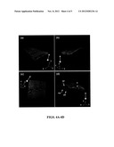 FOUR-DIMENSIONAL OPTICAL COHERENCE TOMOGRAPHY IMAGING AND GUIDANCE SYSTEM diagram and image