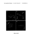 FOUR-DIMENSIONAL OPTICAL COHERENCE TOMOGRAPHY IMAGING AND GUIDANCE SYSTEM diagram and image