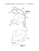 Headgear for Mounting Surgical Headlight diagram and image