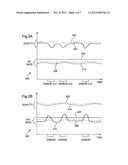 On-demand intra-refresh for end-to end coded video transmission systems diagram and image