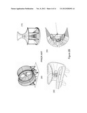 METHOD AND DEVICES FOR COMPACT FORCED VELOCITY TURBINES diagram and image