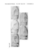 Methods for Promoting the Revascularization and Reenervation of CNS     Lesions diagram and image