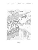 COMPOSITIONS AND METHODS RELATED TO MIRNA IN DIABETIC CONDITIONS diagram and image