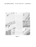 COMPOSITIONS AND METHODS RELATED TO MIRNA IN DIABETIC CONDITIONS diagram and image