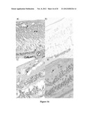 COMPOSITIONS AND METHODS RELATED TO MIRNA IN DIABETIC CONDITIONS diagram and image