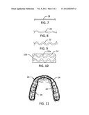 Dental appliance with tension band and method for making diagram and image