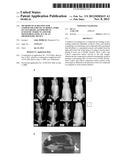 METHODS OF SCREENING FOR COMPOUNDS FOR USE AS MODULATORS OF LEFT-RIGHT     ASYMMETRY IN SCOLIOTIC SUBJECTS AND FOR MONITORING EFFICACY OF AN     ORTHOPAEDIC DEVICE diagram and image