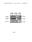 METHODS OF SCREENING FOR COMPOUNDS FOR USE AS MODULATORS OF LEFT-RIGHT     ASYMMETRY IN SCOLIOTIC SUBJECTS AND FOR MONITORING EFFICACY OF AN     ORTHOPAEDIC DEVICE diagram and image