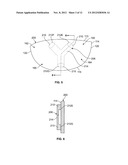 Golf Club Head or Other Ball Striking Device Having Stiffened Face Portion diagram and image