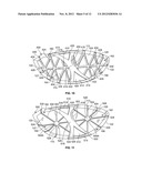 Golf Club Head or Other Ball Striking Device Having Stiffened Face Portion diagram and image