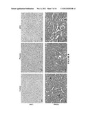 COMPOSITION AND METHOD FOR TREATING COGNITIVE IMPAIRMENTS IN DOWN SYNDROM     SUBJECTS diagram and image